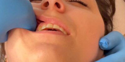 Rehabilitacja stomatologiczna